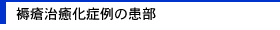 褥瘡治癒化症例の患部